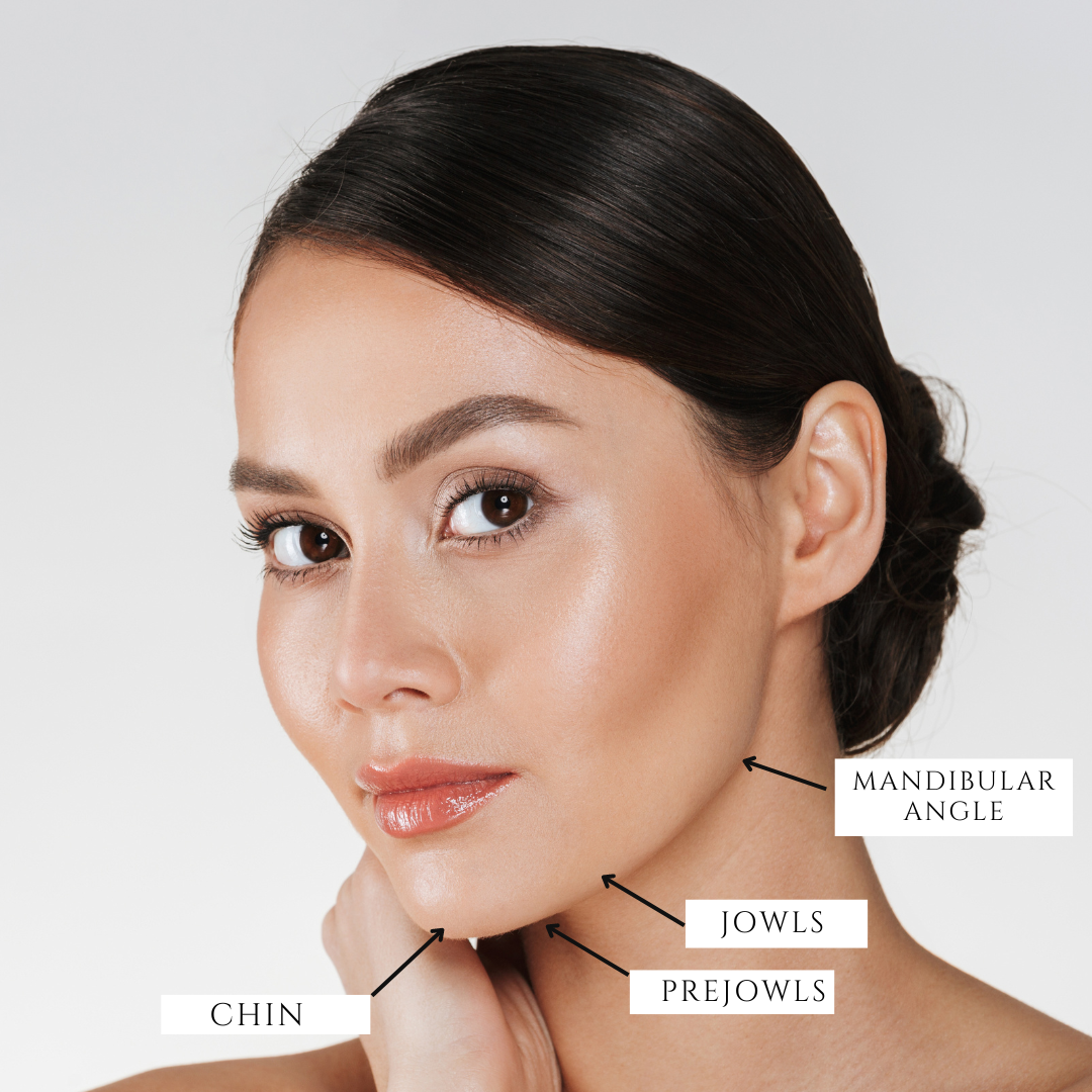 Jawline Filler Injection Areas