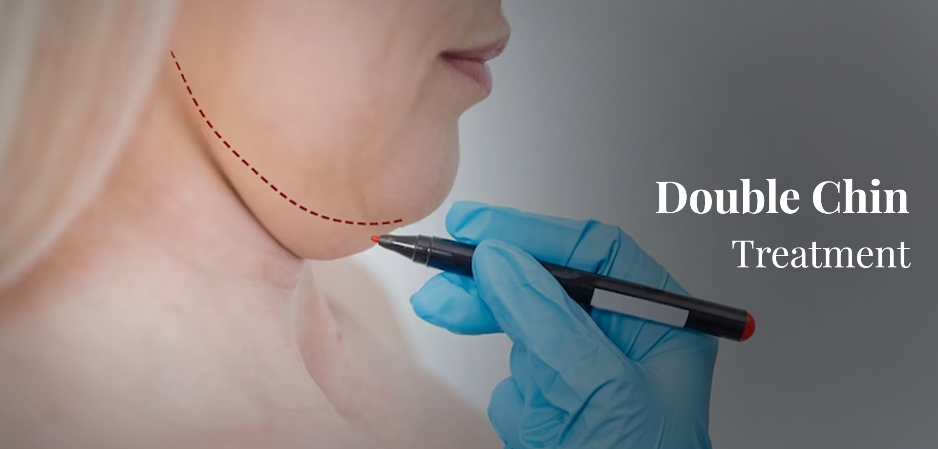Best double chin treatment in South Mumbai